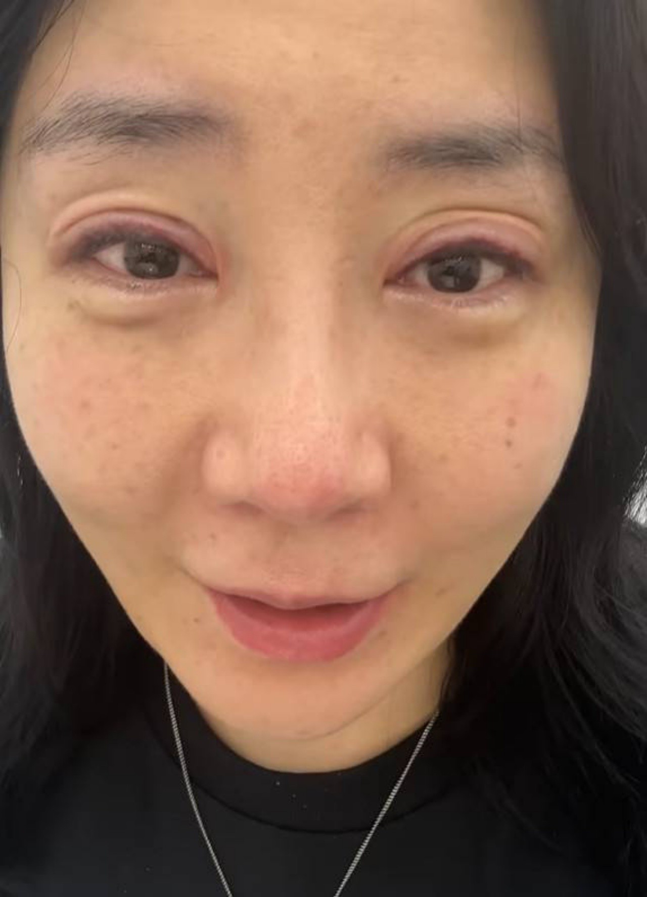 사진=허안나 인스타그램